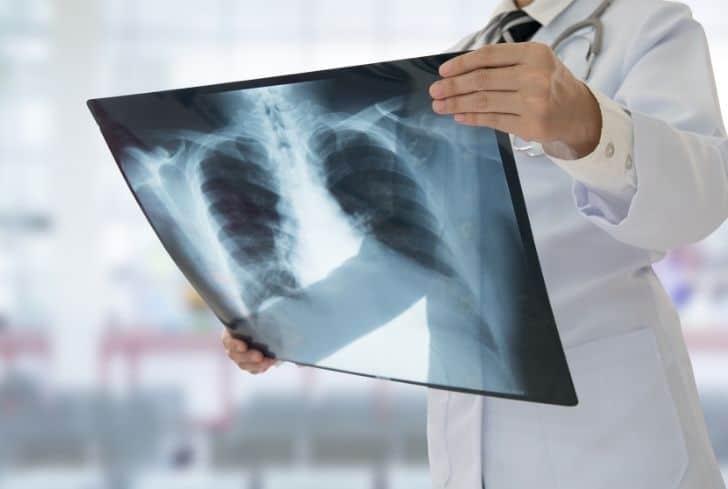 醫(yī)療廢物X射線報告銷毀 醫(yī)療廢物X射線報告銷毀